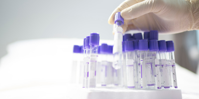 Vaccine Temperature Monitor